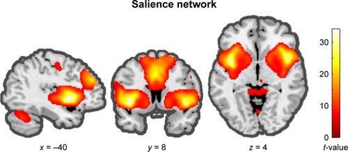 Figure 1 The ICA analysis results.