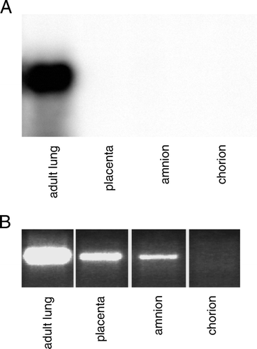 Figure 4.  SP-C is expressed in human placenta and fetal membranes. A: The amount of total RNA used in Northern blot: 5 µg for lung and 15 µg for other tissues. B: RT-PCR (30 cycles) was performed to study the SP-C expression in human tissues. Tissues were obtained from normal term delivery or during surgical procedure. RT-PCR: reverse transcriptase polymerase chain reaction, SP-C surfactant protein C gene.