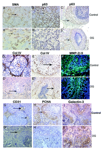 Figure 4. Immunohistochemical analysis of the MCF10ADCIS.com xenografts from water and OG fed mice. (A–I): water fed; (A’–I’): OG fed. A&B: 12 d; D: 21 d; C,E-I: 35day. (A,A’): smooth muscle actin, (B,B’): p63; (C,C’): p63; (D,D’): collagen IV. (E,E’): collagen IV; (F,F’): in situ zymography for MMP activity; (G,G)’: CD31; (H,H’): PCNA; I,I’:Intact Galectin-3. (A,B,G,H,I) × 200; (C,D,E) × 400. Arrows indicate positive staining.