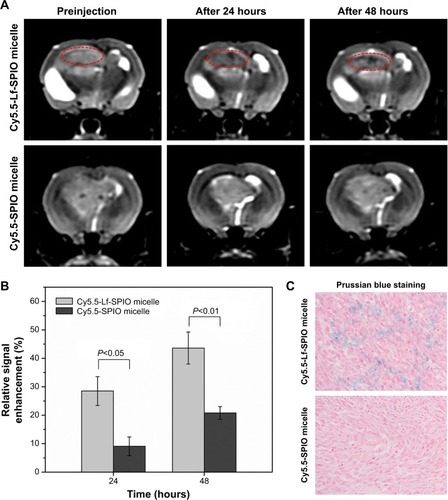 Figure 6 In vivo study on magnetic resonance imaging.Notes: (A) In vivo T2-weighted magnetic resonance images of rat brain bearing C6 glioma (n=6). Upper row, acquired after administration of Cy5.5-Lf-SPIO micelles (12 mg Fe/kg); lower row, acquired after administration of Cy5.5-SPIO micelles (12 mg Fe/kg). (B) The relative signal enhancement of the brain tumor in the T2-weighted image at 24 and 48 hours (expressed as means ± standard error of mean [n=6]). (C) Histological sections of glioma with Prussian blue staining (400×).Abbreviations: Lf, lactoferrin; SPIO, superparamagnetic iron oxide.