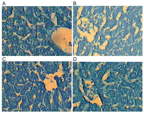 Figure 2.  A photomicrograph of section of liver of (A) control rat showing the proteinic contents. Notice the irregular particles of various sizes that are equally distributed in the cytoplasm of the liver cells. The nucleoli are intensely stained while the ground cytoplasm and nucleoplasm display faint stainability, (B) rat liver received a single oral dose of paracetamol equivalent to 3 g/kg BW showing the stainability of the proteinic inclusions of the hepatocytes. The stainability is relatively diffused in both the cytoplasm and nucleus, (C) rat daily received an oral dose equivalent to 200 mg/100 g BW of total 70% methanol extract of L. leonurus for seven successive days and received a single oral dose of paracetamol (3 g/kg BW) on day 8 showing the proteinic inclusions in many liver cells. Notice that the stainability is mostly diffused in cytoplasm and nuclei, and (D) rat daily received an oral dose equivalent to 200 mg/100 g of chloroform extract of L. leonurus for seven days and received a single oral dose of paracetamol (3 g/kg BW) on day 8 showing the proteinic inclusions. Notice that in some cells the proteinic particles are relatively few in number. No change was observed in most hepatocytes (Bromophenol blue reaction-X 600).