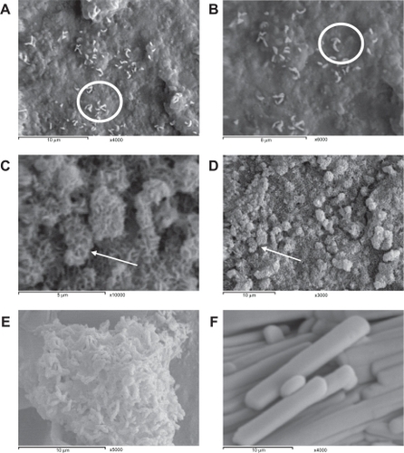 Figure 1 Nanoparticles (A), close up of theophylline nanoparticles (B), theophylline controlled agglomerates (C), close up of theophylline controlled agglomerates (D), aggregation of theophylline nanoparticles upon using high concentration of NaCl (E), and theophylline powder without processing (F). Note the circles that showing the mechanism of self-assembly of nanorods on a copper grid. The arrows show fluffy spherical nanorods of the controlled agglomerates.