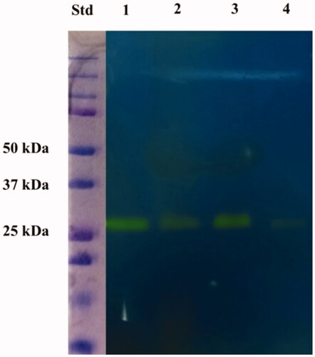 Figure 1. Protonography of whole lymphocyte extracts prepared from tumour and adjacent healthy tissues as well as from peripheral blood of a patient with intestinal adenocarcinoma included in this study. The gel was run under denaturing but non-reducing conditions. Protonography showed a yellow band migrating with a rough molecular mass of about 26 kDa, which corresponds to the hydratase activity. Legend: Lane Std, molecular markers (from bottom to the top: 25 kDa, 37 kDa, 50 kDa, and others); lane 1, commercial bovine CA used as positive control; lane 2, lymphocyte collected from the tumour tissue; lane 3, lymphocyte collected from adjacent healthy tissues; lane 4, lymphocyte collected by PBMCs.
