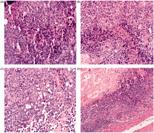 Figure 5. Histological (H&E) analysis of tumor samples from different treatment groups. Group A: saline group; group B: 10-HCPT injection group; group C: 0.75 mg/kg 10-HCPT- HES conjugate group; group D: 1.5 mg/kg 10-HCPT-HES conjugate group.