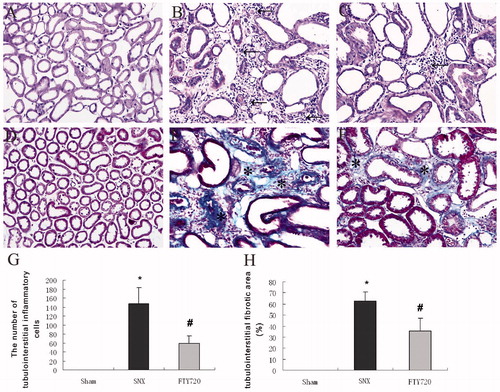 Figure 3. FTY720 attenuates the tubulointerstitial histological changes in the subtotally nephrectomized rats. Representative examples of PAS stains (A–C) and Masson stains (D, E) showing the tubulointerstitial histological changes (original magnification: ×200). Semiquantitative analyses of the tubulointerstitial inflammatory cells (G) and tubulointerstitial fibrosis (H). The tubulointerstitial fibrotic area and the number of inflammatory cells was markedly increased in the SNX animals compared with sham and was lower in SNX+FTY720 group; n = 8, *p < 0.01 versus sham, #p < 0.01 versus SNX.
