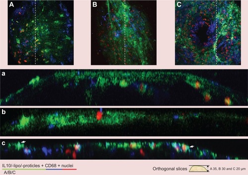 Figure 5 Plaque imaging of IL10-coupled NPs compared to uncoupled IL10.Notes: Aortic sections of ApoE-deficient mice were incubated with (A) Atto655-labeled IL10, (B) IL10-coupled Atto655-labeled liposomes or (C) rhodamine-labeled IL10-coated proticles. Atto655 was purchased from ATTO-TEC GmbH, Siegen, Germany. The pictures show vertical fluorescence light images from atherosclerotic-plaques that are similar in size. Aortic sections were co-stained with anti-CD68 for macrophages (shown in blue) and with Hoechst (Thermo Fisher Scientific, Waltham, MA, USA) for nuclei (shown in red). By applying IL10 alone (a) the signal was found in deeper areas of the plaques which was comparable to IL10-Atto655-liposomes (b) where the signal was more condensed. IL10-Rho-proticles were found to greatly accumulate at the plaque surface area; arrows point to areas of strong co-localization with CD68 positive macrophages (c).Abbreviations: IL10, interleukin 10; NPs, nanoparticles; lipo, Atto655-labeled liposomes; ApoE, apolipoprotein E; Rho, rhodamine.