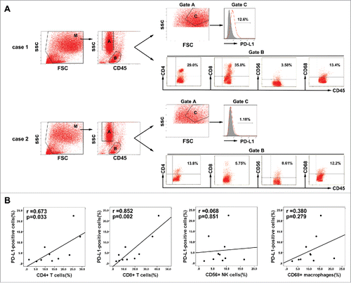 Figure 6. Association between PD-L1 expression on tumor cells and infiltration of inflammatory cells in HCC microenvironment. (A) Gating routine for the identification of tumor cells and CD45+ cells is shown. Flow cytometric analysis was performed to measure PD-L1 expression on tumor cells(gate C) and CD4+, CD8+, CD56+, and CD68+ cell subsets gating on the CD45+fraction(gate B). Significantly higher percentages of CD4+ T cells and CD8+ T cells were observed in the HCC tumor tissues with high PD-L1 expression (case 1) compared to that with low PD-L1 expression (case 2). (B) A summary of correlation analysis was shown that PD-L1 positive tumor cells in tumor tissues significantly correlated with tumor-infiltrating CD4+ and CD8+ T cells, but not associated with CD56+ NK cell and CD68+ macrophage (n = 10).