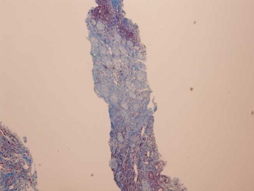 Figure 4. HH trichrome of glomerular cortex 4×.