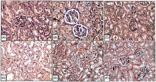 Figure 5. Representative photomicrographs of Bcl-2 expression determined by immunohistochemistry. Notes: [A, B, and C] There is normal expression of Bcl-2 in the cortical regions of kidney in control, GSPE, and FO treated rats about 80, 82, and 79%, respectively. However, cisplatin administration decreased strongly Bcl-2 expression which is about 30% in inner cortical and outer medullary areas especially in the proximal convoluted tubules [D]. On the other hand, there was an increase of Bcl-2 expression as evidenced by strong immunostaining in the distal tubules in the cortical regions of rat kidneys treated with GSPE or FO before cisplatin which are about 50 and 53% [E, F]. Brown color indicates immunopositivity.