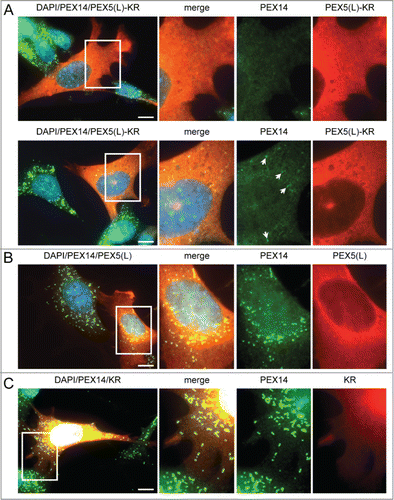 Figure 1. Expression of PEX5-KR triggers the removal of peroxisomes. SV40T-MEFs were transfected with plasmids encoding either (A) PEX5(L)-KR, (B) PEX5(L), or (C) KR. One day later, the cells were fixed, counterstained with DAPI, and processed for immunofluorescence with anti-PEX5 and/or anti-PEX14 antibodies followed by TxRed- and/or Alexa Fluor 488-conjugated secondary antibodies. (A) Upper and lower panels show a transfected cell where all, or most, peroxisomes are absent, respectively. Arrows indicate some of the remaining peroxisomes. Scale bar: 10 µm.