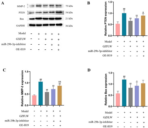 Figure 5. GZFLW affected the activity of the H19/miR-29b-3p signaling pathways. (A–D) Western blot analysis of PTEN, MMP-2 and Bax proteins transfected with miR-29b-3p or expression of H19. ##p < .01 in comparison with controls, *p < .05 and **p < .01 in comparison with model, &p < .05 and &&p < .01 in comparison with GZFLW.