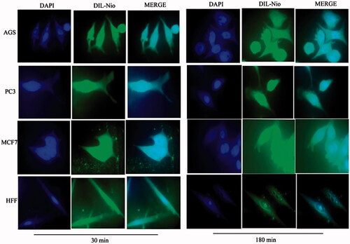 Figure 7. Cellular uptake images of AGS, PC3, MCF7 and HFF cells, incubated with DIL-labeled Niosome (DIL-Nio) for 30 min and 180 min. DAPI (blue) was used for nucleus staining and DIL dye (green) was used for phospholipid staining.