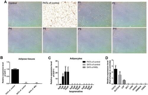 Figure 2 Isolation and characterization of hADSCs and ATLLM from MSL patients. (A) Immunohistochemistry. Expression of the UCP-1 protein was assessed in the ATLLM from MSL SATs, control SATs, and PATs. (B) qRT-PCR. The level of UCP-1 mRNA was detected in the ATLLM from MSL SATs (n = 6) and control SATs (n = 6) and PATs (n = 4). (C) qRT-PCR. The level of UCP-1 mRNA in the induced mature adipocytes with different concentration isoprenaline stimulation in MSL SATs (n = 6) and control SATs (n = 6) and PATs (n = 4). (D) qRT-PCR. The expression of the white and brown adipose markers in induced mature adipocytes from the MSL (n = 6) and control (n = 6). Representative blots are shown and the data is represented by the mean plus or minus SEM from 3 experiments. **P< 0.01 vs PATs of control; ##P < 0.01 vs 0 μM isoprenaline stimulation of control PATs; ΔP< 0.05, ΔΔP< 0.01 vs control.