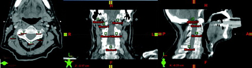 Figure 1.  Visualization of the positioning of landmark points on the images acquired from the head and neck cancer patient.