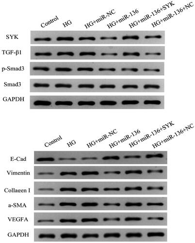 Figure 13. Expression levels of TGF-β1, p-Smad3, and Smad3 in each group. When cells were treated with various reagents, the protein level was detected by WB.