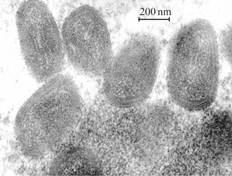 FIG. 1 Microscopic photographs of the Vaccinia virus.