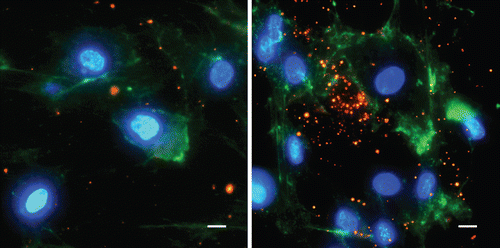 Figure 3.  Cellular uptake of Cx31.1-PLGA3% nanoparticles incubated at 4 °C (left) and 34 °C (right) respectively for 8 h; merged images of Cy3-AsODN-loaded nanoparticles (red), cell nuclei stained with DAPI (blue) and cell membranes labeled with WGA Alexa 488 (green); (scale bar = 10 µm)