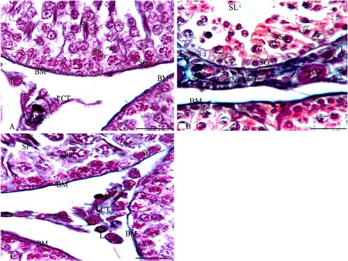 Figure 4. Photomicrographs from the testes of rabbits that were stained with MT. A section from G1 in Figure 4A shows boundaries between two ST that are surrounded by a thin BM and separated by a thin interstitial tissue of loose connective tissue (LCT). Each ST is lined by several layers of spermatogenic cells as SG, PS and SP with SE cells that rest on the BM. Multiple L cells appear around a small blood vessel (BV) in LCT between the ST. Additionally, sections of G2 as in Figure 4B reveal that ST are surrounded by a thick BM and separated by a thick, wide LCT of collagen fibres with multiple L cells around a small congested BV and the ST are lined with spermatogenic cells as SG and PS. Also, their lumen has multiple SL. A section from G3 in Figure 4C reveals boundaries of three ST that are surrounded by a thin BM and separated by a thin LCT with multiple L cells between the ST while each ST is lined by several layers of spermatogenic cells as SG that rest on the BM, PS and SP similar to those of G1. MT × 1000 and the bar = 50 μm.