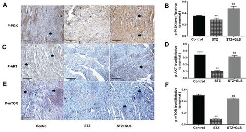 Figure 8 Effect of Ganoderma lucidum spores (GLS) on the protein expression of p-PI3K, p-Akt, and p-mTOR according to immunohistochemical results (A, C and E) and their statistical analysis (B, D and F) in cardiac tissues in different groups. (Micrographs, magnification 400×. Arrows indicate the changed areas. Values represent the mean ± SE; n = 3 in each group. **, p < 0.01 versus the control group and ##, p < 0.01 versus STZ group using Tukey’s test. Control: 5 mL/kg saline (p.o.); Diabetic: 50 mg/kg streptozotocin (i.p.) and 5 mL/kg saline (p.o.); STZ+GLS: 50 mg/kg streptozotocin (i.p.) and 300 mg/kg GLS (p.o.).