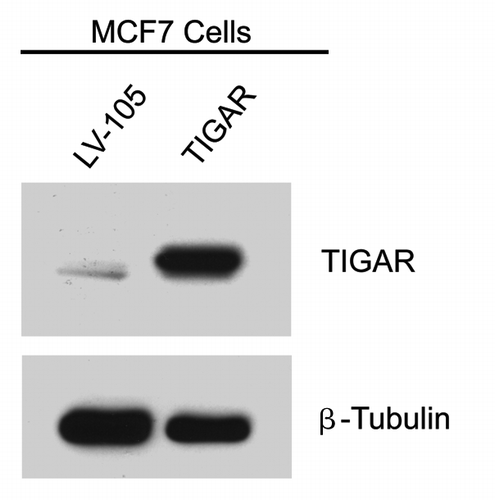 Figure 6. Generation of TIGAR overexpressing MCF7 cells. MCF7 cells recombinantly overexpressing TIGAR and empty vector control (LV-105) were generated and subjected to protein gel analysis with antibodies against TIGAR. As expected, the TIGAR overexpressing MCF7 cell line shows higher levels of TIGAR than the control. β-tubulin was used as an equal loading control.
