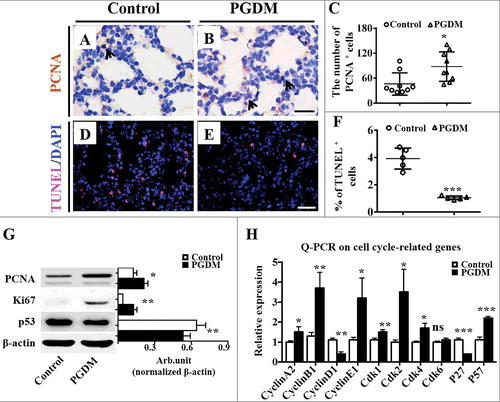 Figure 2. Assessment of cell proliferation and apoptosis of mouse lungs in the presence of high levels of glucose. A-B: PCNA immunohistochemistry was performed on the transverse sections of embryonic (E18.5) mouse lungs from the control (A) and PGDM (B) groups. All of the sections were counterstained with haematoxylin. C: The point and figure chart compares the PCNA+ cell numbers of mouse lung sections between the control and PGDM groups. D-E: TUNEL immunohistochemistry was performed on the transverse sections of embryonic (E18.5) mouse lungs from the control (D) and PGDM (E) groups. All of the sections were counterstained with haematoxylin. F: The point and figure chart compares the percentage of TUNEL+ cell of mouse lung sections between the control and PGDM groups. G: The Western blotting data show the protein expressions of PCNA, Ki67 and p53 from the lung tissues of control and PGDM mice at E18.5 embryonic days. F: The qPCR data shows the expression levels of cyclinA2, cyclinB1, cyclinD1, cyclinE1, cdk1, cdk2, cdk4, cdk6, p27 and p57 in E18.5 mouse lung tissues from the control and PGDM groups. Scale bars = 20 μm in A-B and 25 μm in D-E. *P < 0.05, **P<0.01, ***P<0.001.