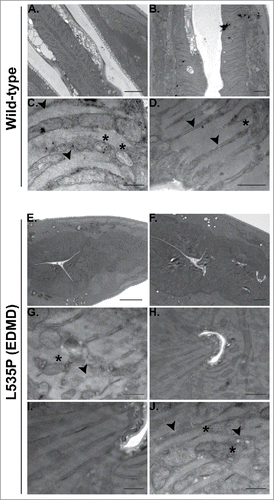 Figure 4. Aberrant pharyngeal muscle structure in L535P animals. Electron microscopy was used to analyze the effects of the L535P EDMD lamin mutation on pharyngeal muscle organization. (A-D) wild type animals. (E-J) L535P animals. In wild-type animals sarcomeres and muscle fibers were well aligned with mitochondria embedded between them (C-D; black arrowheads and Asterisk, respectively). In contrast, L535P animals had overall aberrant pharynx morphology (E-F), with loss of sarcomere, muscle fiber and mitochondria organization (G and J; black arrowheads and Asterisk, respectively).