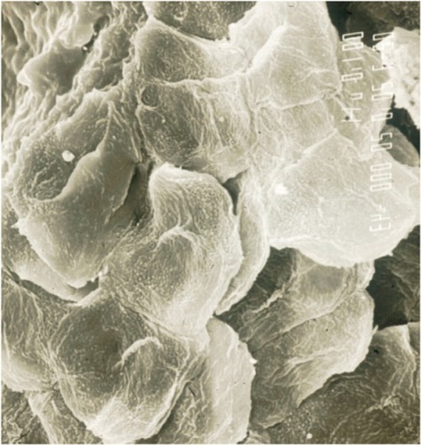 Figure 3 Corneocyte clumpiness collected on a CSSS (scanning electron microscopy).
