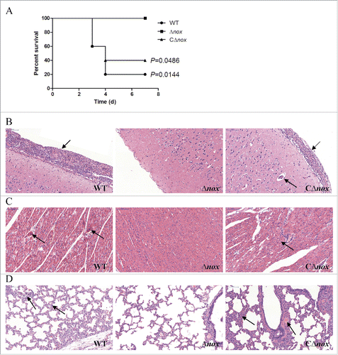 Figure 6. Role of NADH oxidase in S. suis 2 virulence in the pig infection model. A, Survival curves of pigs infected with S. suis strains. Animals inoculated with PBS are not shown for simplicity. P = 0.0144 for comparison of the Δnox group with the WT group, and P = 0.0486 for comparison of the Δnox group with the CΔnox group (the log-rank test). B, Pathological examination of brain tissues of the infected pigs. C, Pathological examination of heart tissues of the infected pigs. D, Pathological examination of lungs tissues of the infected pigs. Arrowheads show the pathological changes. Representative images are shown for each group. Bars, 100 μm.