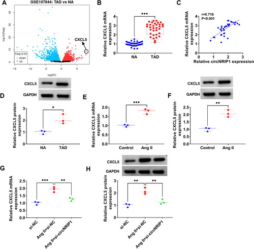 Figure 3. CXCL5 expression in TAD patients and Ang II-induced HA-VSMCs. (A) Volcano plots showed the differentially expressed mRNAs in TAD patients and NA in GSE107844 dataset. (B) CXCL5 mRNA expression in the aortic specimens of TAD patients and NA was detected by qRT-PCR. (C) Pearson correlation coefficient was used for assessing the correlation of CXCL5 mRNA expression and circNRIP1 expression in TAD patients. (D) CXCL5 protein expression was detected by WB analysis in the aortic specimens of TAD patients and NA. (E-F) CXCL5 mRNA and protein expression in HA-VSMCs treated with or without Ang II was examined by qRT-PCR and WB analysis. (G-H) CXCL5 mRNA and protein expression was tested by qRT-PCR and WB analysis in Ang II-induced HA-VSMCs transfected with si-NC/si-circNRIP1. *p < 0.05, **p < 0.01, ***p < 0.001.