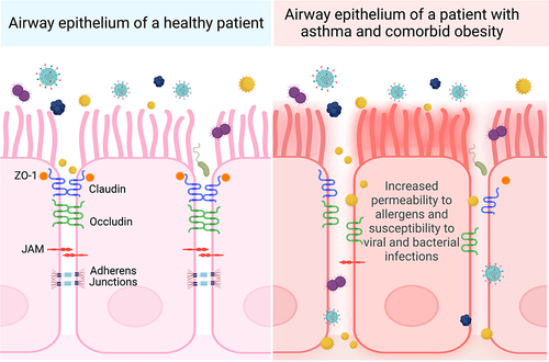 Figure 3 Comparison of postulated apical junctional protein organization in patients with asthma and comorbid obesity versus healthy patients. Airway epithelial cells are kept in close contact with adjacent epithelial cells through an organized arrangement of tight junction (ZO-1, claudin, occludin) and adherens junction proteins. People with asthma and comorbid obesity may have more severe asthma exacerbations caused by allergens, viral and bacterial pathogens, or pollutants, contributing to elevated oxidative stress. This may disrupt the organization expression levels of junction proteins, resulting in airway epithelium permeability. Created with Biorender.com.