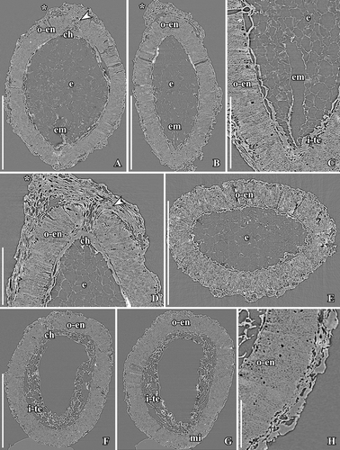 Figure 12. SRXTM images of Canrightiopsis crassitesta gen. et sp. nov. Internal structures, from the Early Cretaceous Catefica locality, Portugal (sample Catefica 49). A–E. Longitudinal (A–D) and transverse (E) orthoslices of fruit in different directions showing thin-walled cells of collapsed fruit wall and thick endotesta (o-en); palisade cells of endosperm with fibrous infilling and scattered crystals (best seen in C); endosperm (e) partly preserved inside the seed and a narrow hollow in the endosperm marks the position of the embryo (em); stigmatic area marked by asterisk and vascular bundle to chalaza (ch) by arrowhead (S174159). F–G. Longitudinal orthoslices of fruit in two directions showing thin-walled cells of collapsed fruit wall, thick endotesta (o-en), and thin-walled cells of tegmen (i-te); apical chalaza (ch) seen in (F) and basal micropyle (mi) seen in (G) (S174039). H. Detail of fruit and seed wall in same specimen as in (F, G), showing the collapsed cells of the fruit and the high endotestal cells (o-en). Scale bars – 500 µm (A, B, E–G), 200 µm (C, D), 100 µm (H).