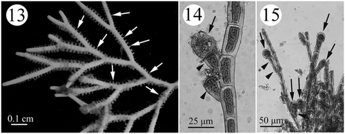 Figs. 13–15. Development of tetrasporangial structures in Actinotrichia fragilis (#SLL HK-07-18-2002-1). Fig. 13. Branches of a tetrasporic plant showing the whorled assimilatory filaments (arrows) where the tetrasporangia develop. Fig. 14. A tetrasporangium-producing (arrow) tetrasporangial mother stalk cell (arrowheads) produced laterally from the assimilatory filament. Fig. 15. Tetrasporangia (arrows) are produced terminally or laterally from assimilatory filaments. Distinct one- to two-celled stalks of lateral tetrasporangial mother cells (arrowheads) are visible.
