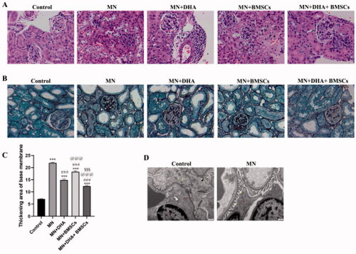 Figure 1. Identification of the MN mouse model. (A) H&E staining showing histopathological changes in renal tissue (original magnification ×400; scale bar 10 μm). (B,C) PASM staining showing a thickened area of the basal membrane of the glomerulus and renal tubule. (D) TEM ultrastructure of renal tissue (original magnification ×6000, scale bar 500 nm). Red: mitochondria (Mi), nucleus (N). Yellow: foot process. Values are expressed as the mean ± SD, n = 5 per group. *p < .05 versus control group; ***p < .001 versus control group; #p < .05 versus MN model group; ###p < .001 versus MN model group; @p < .05 versus MN + DHA group; @@@p < .001 versus MN + DHA group; $p < .05 versus MN + BMSCs group; $$$p < .001 versus MN + BMSCs group.