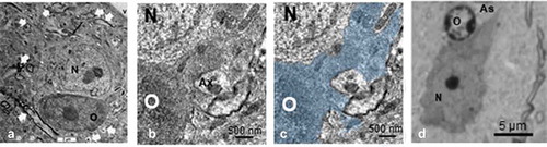 Figure 14. ODS 48h oligodendrocyte satellites (O) and nerve cell bodies (N) of murine thalamus. A: Neuron with huge branched mitochondrial profile in a dendritic extension (long black arrow) surrounded by its oblique to cross-sectioned axonal profile extensions (white arrows). The dark, contrasted satellite oligodendrocyte has an extension that is seen wrapping a neurite profile at the low right quadrant (curved arrow), enlarged in B and C with the oligodendrocyte part filled by a transparent blue hue. A similar aspect of A, found in semi-thin sections is also depicted in D. V: capillary lumen