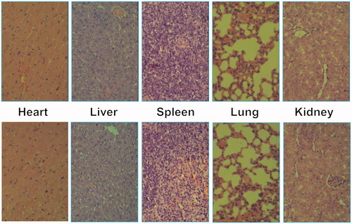 Figure 10. Representative HE stain image of organ histology by Tf-HPAA-MTX/pMMP-9 (top row) and PBS control (bottom row).