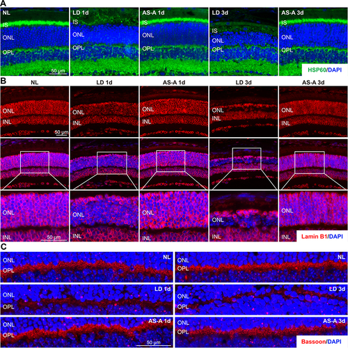 Figure 7 AS-A protects against bright light-induced impairment of mitochondria, nuclear envelope and synaptic ribbon in photoreceptors. Eyes were enucleated from the indicated treatment groups 1 d and 3 d after bright light exposure. (A–C) IHC examination was performed to detect HSP60 (in green) (A), lamin B1 (in red) (B) and bassoon (in red) (C) in the retina (n=5-6 per group). DAPI (in blue) was counterstained.