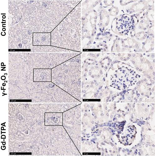 Figure 6 Histological images of kidney tissue staining with TGF-β. The right collum was magnified area in the rectangle in the left collum. The scale bar is 250 μm in the left and 50 μm in the right.