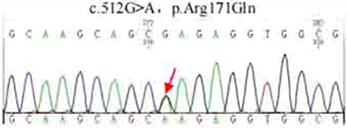Figure 3 Sequencing peak of probands of family 2.