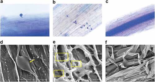 Figure 1. Colonization pattern of P. indica in wheat roots.