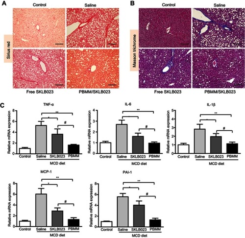Figure 7 Anti-fibrosis efficacy of PBMM/SKLB023 in a mouse model of NASH induced with a diet deficient in choline and methionine (MCD diet). Liver tissue from mice after treatment with different formulations was stained with (A) Sirius Red or (B) Masson trichrome. Scale bar: 100 μm. (C) Liver tissue was homogenized and assayed for relative levels of mRNAs expressing TNF-α, IL-6, IL-1β, MCP-1, and PAI-1. *P<0.05 and **P<0.01 vs saline-treated NASH animals, #P<0.05 vs free SKLB023 (n=6 for each group).