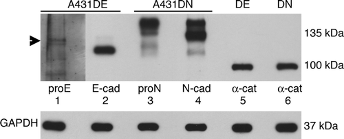 Figure 2.  Characterization of cadherin antibodies. TNE extracts (50 µg) from A431DE and A431DN cells were resolved by 7% SDS-PAGE and immunoblotted with anti-pro-E-cadherin antiserum, HECD-1 monoclonal anti-E-cadherin, 10A10 monoclonal anti-pro-N-cadherin, 13A9 monoclonal anti-N-cadherin, or 1G5 monoclonal anti-α-catenin. GAPDH was used as a loading control.