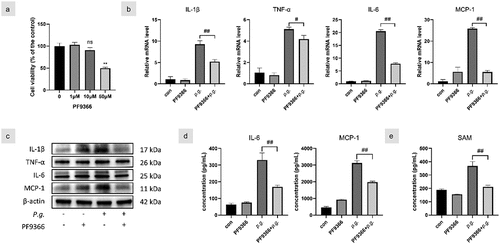 Figure 3.  MAT2A inhibition decreased P. gingivalis-induced inflammatory responses in hGfs.