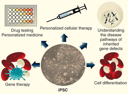Figure 1. Possible applications of induced pluripotent stem cells.iPSC: Induced human pluripotent stem cells.