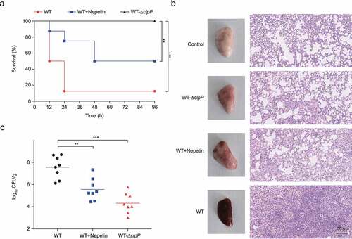 Figure 4. Nepetin protects mice from MRSA pneumonia. (a) Survival of mice treated with nepetin (100 mg/kg) at the indicated times after infection with USA300 (2e8 CFU/30 µl). Significance (p-value) in the panels except (a) is calculated using log-rank test: **P < .01 and ***P < .001. (b) Gross pathology and histopathology of S. aureus USA300 and USA300-Δclpp infected lung tissue from mice. Nepetin (100 mg/kg) treatment by subcutaneous injection. Scale bar, 50 μm. (c) the infectious bacterial load in the lung of mice with nepetin (100 mg/kg) treatment. in the graph, horizontal bars indicate the mean of bacterial load measurements, each dot represents a mouse. Significance is calculated based on one-way ANOVA: **P < .01 and ***P < .001.