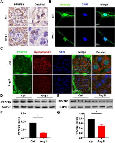 Figure 2. Angiotensin II stimulation induced decreased PFKFB3 expression in podocytes. (A) Representative Immunohistochemical staining of PFKFB3 in glomeruli from different groups. Scale bars: 20 µm. (B) Representative immunofluorescence image of PFKFB3 in ctrl and Ang II-treated podocytes in cultures obtained by confocal microscopy, Scale bars: 20 μm. (C) Representative immunofluorescent staining of PFKFB3 (green) and synaptopodin (podocyte‐specific marker, red) in ctrl and Ang II-infused mice, Scale bars: 20 µm. (D) Representative Western blots of PFKFB3 in glomeruli from ctrl and Ang II-infused mice. (E) Representative Western blots of PFKFB3 in ctrl and Ang II-treated podocytes in cultures. (F) Quantitative determination of Western blots of PFKFB3 expression in ctrl and Ang II-infused mice (n = 6), *p < 0.05. (G) Quantitative determination of Western blots of PFKFB3 expression in ctrl and Ang II- treated podocytes in cultures (n = 3), *p < 0.05.