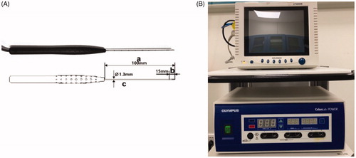 Figure 2. RFA equipment. (A) 18-gauge (diameter 1.3 mm) bipolar RFA needle (with a 15 mm active tip; (B) Olympus Surgical Technologies. RFA: radiofrequency ablation.