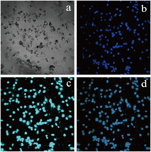 Figure 4 Near-infrared identification imaging with the probe. (a) micrograph of small-cell lung cancer HTB-119 cells; (b) DAPI imaging of small-cell lung cancer HTB-119 cells; (c) near-infrared identification imaging for HTB-119 cells with the NaYF4:Nd@NaGdF4-ProGRP antibody probe (cyan pseudocolor); (d) merged image of the HTB-119 cells identified by the NaYF4:Nd@NaGdF4-ProGRP antibody probe and those identified by DAPI imaging).