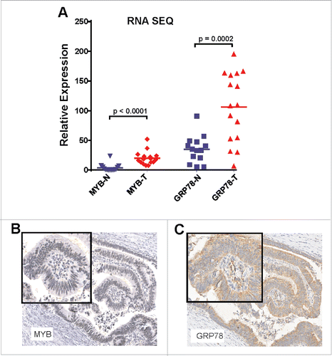 Figure 2. MYB and GRP78 expression is generally higher in colorectal tumors than in normal adjacent mucosa. (A) RNAseq was used to determine significantly higher GRP78 and MYB expression in CRC (T) compared the matched normal mucosa (N). (Two-way, t-test, n = 14 plus 2 addition CRC samples). (B) IHC for MYB and GRP78 antigens in the same region of an early stage MSS CRC.