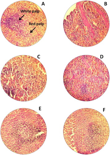 Figure 4. H&E staining of rat spleen. (A) Untreated rat for 14th day (−); (B) Untreated rat for 28th day, normal spleen tissues white palp and red palp (−); (C) Rats treated with Bio-AgNPs, i/p route for 14th day (+); (D) Rats treated with Bio-AgNPs, i/p route for 28th day (−); (E) Rats treated with Bio-AgNPs, i/v route for 14th day (−); (F) Rats treated with Bio-AgNPs, i/v route for 28th day (−). *where (−) indicates no changes, (+) indicates mild changes, (++) indicates moderate changes, (+++) indicates severe changes.