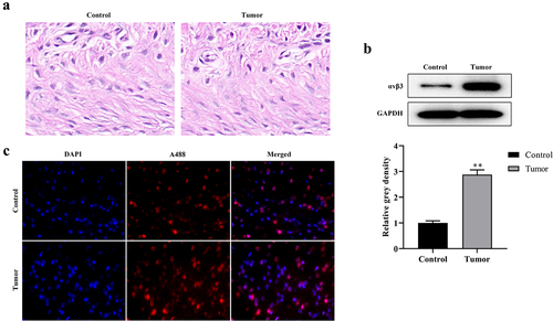 Figure 6. The cRGD-Gd-DTPA-PLGA used for MRI by targeting αvβ3.